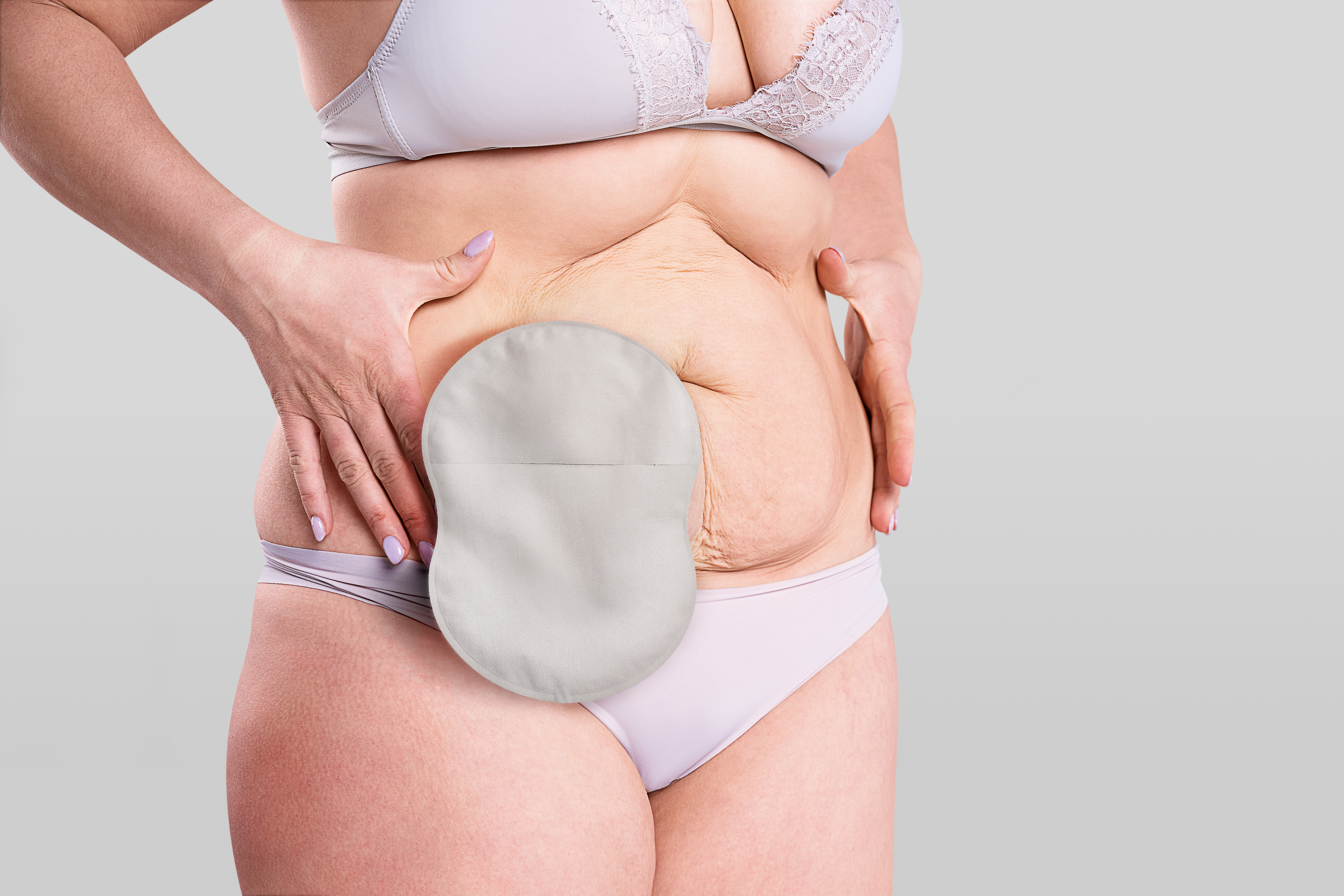Une femme porte une poche de stomie Esteem Body™ en position debout.